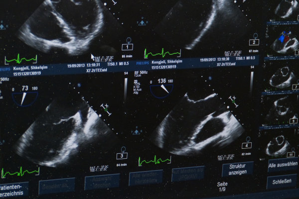 Ultrasound images on screen